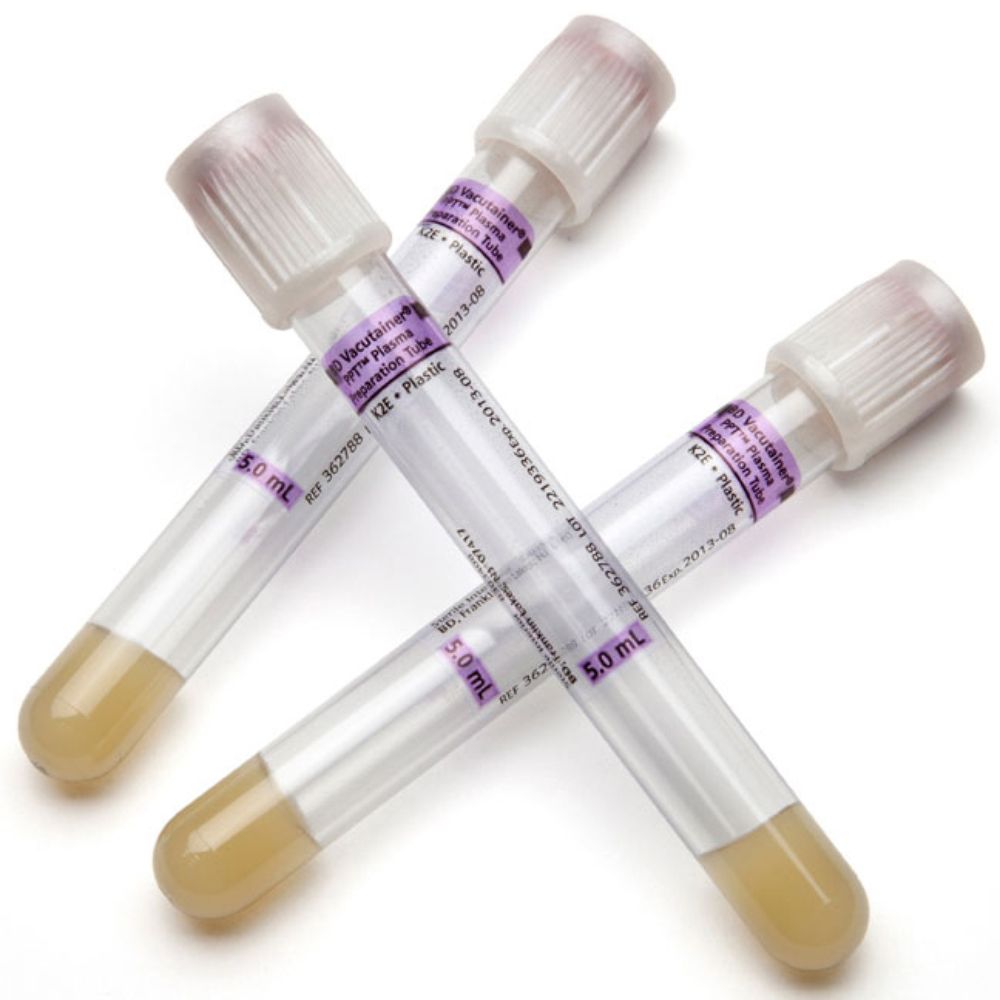 BD Vacutainer® PPT™ Blood Collection Tube K2 EDTA Additive 5 mL 