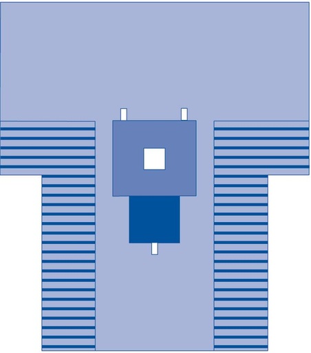 [MED-DYNJP3009] Sterile Laparotomy Drape W/ Pouch | 98" x 78" x 121"